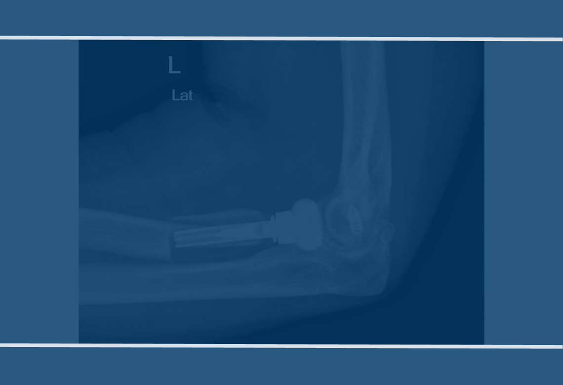 orthopaedic-foot-ankle