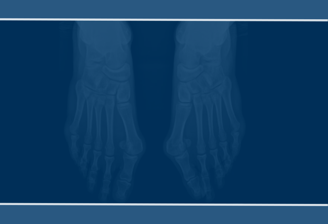 orthopaedic-foot-ankle