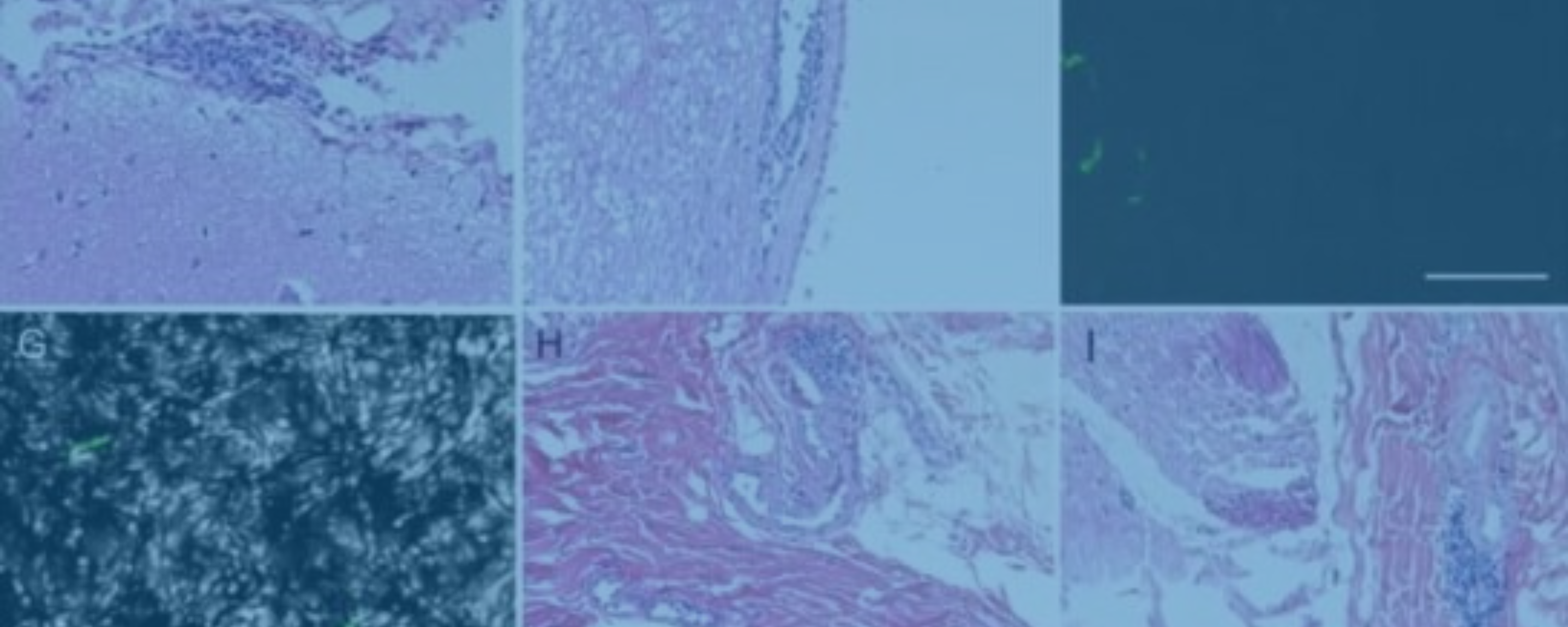 Antibiotic Efficacy for Treatment of Lyme Disease