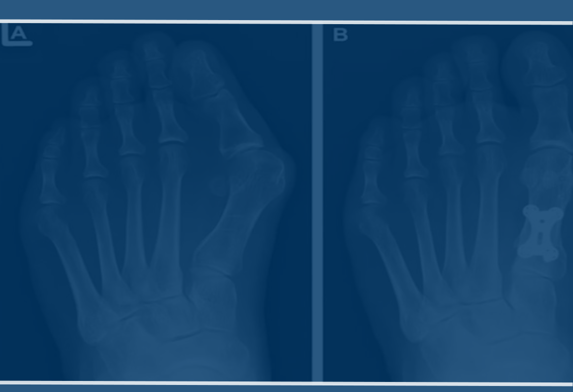 orthopaedic-foot-ankle