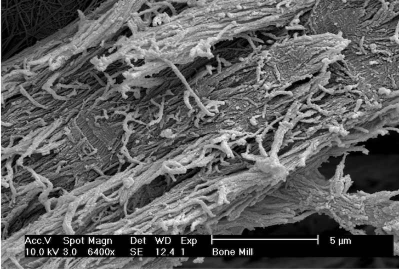 PRF Membranes