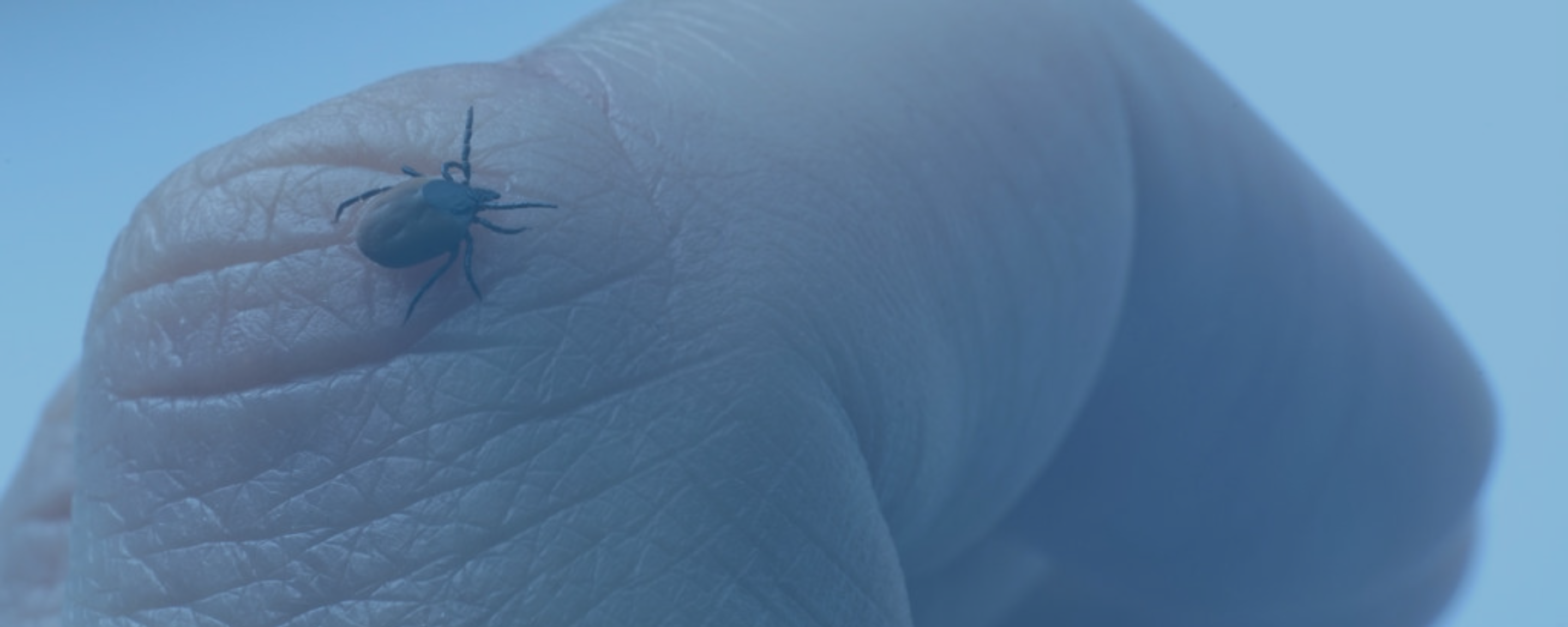 Managing Ixodes Scapularis Bites