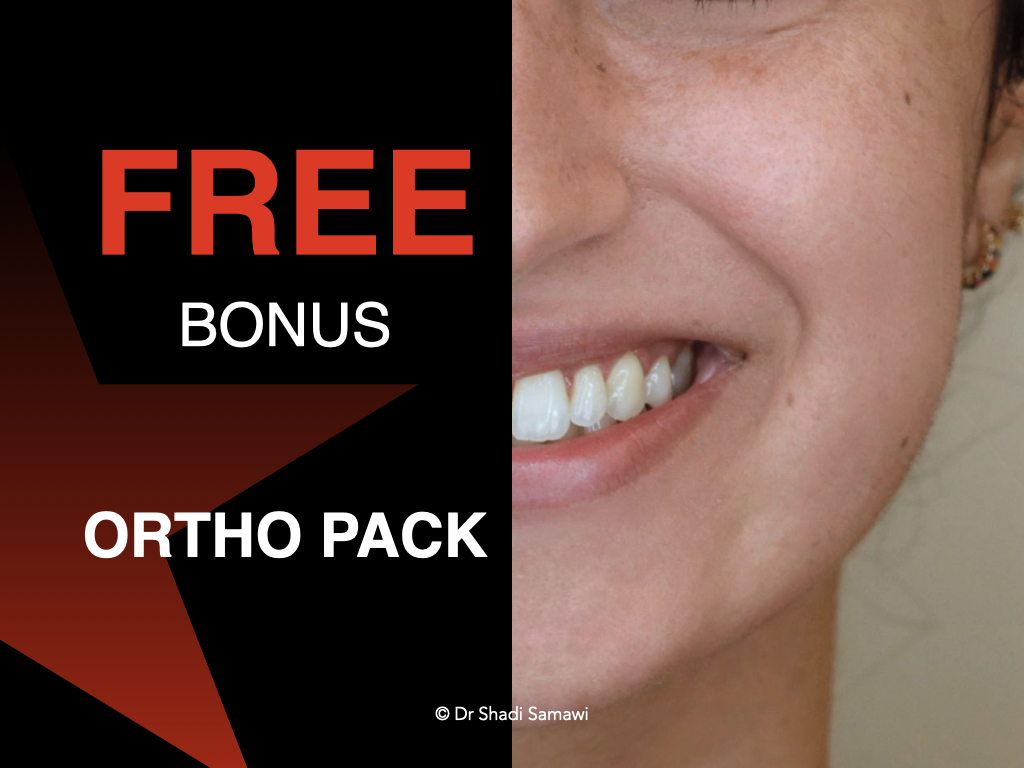 Download this FREE Bonus pack of FOUR eBooks and published articles related to practical aspects of Orthodontics, courtesy of Dr. Shadi Samawi.