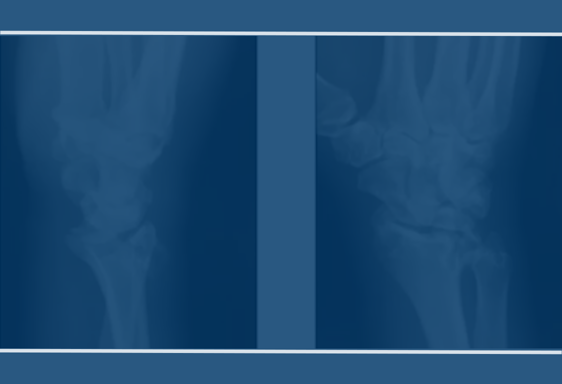 orthopaedic-foot-ankle