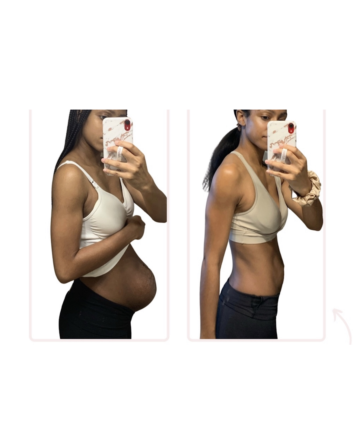 Sign up for your personalized postpartum recovery, Diastasis recti