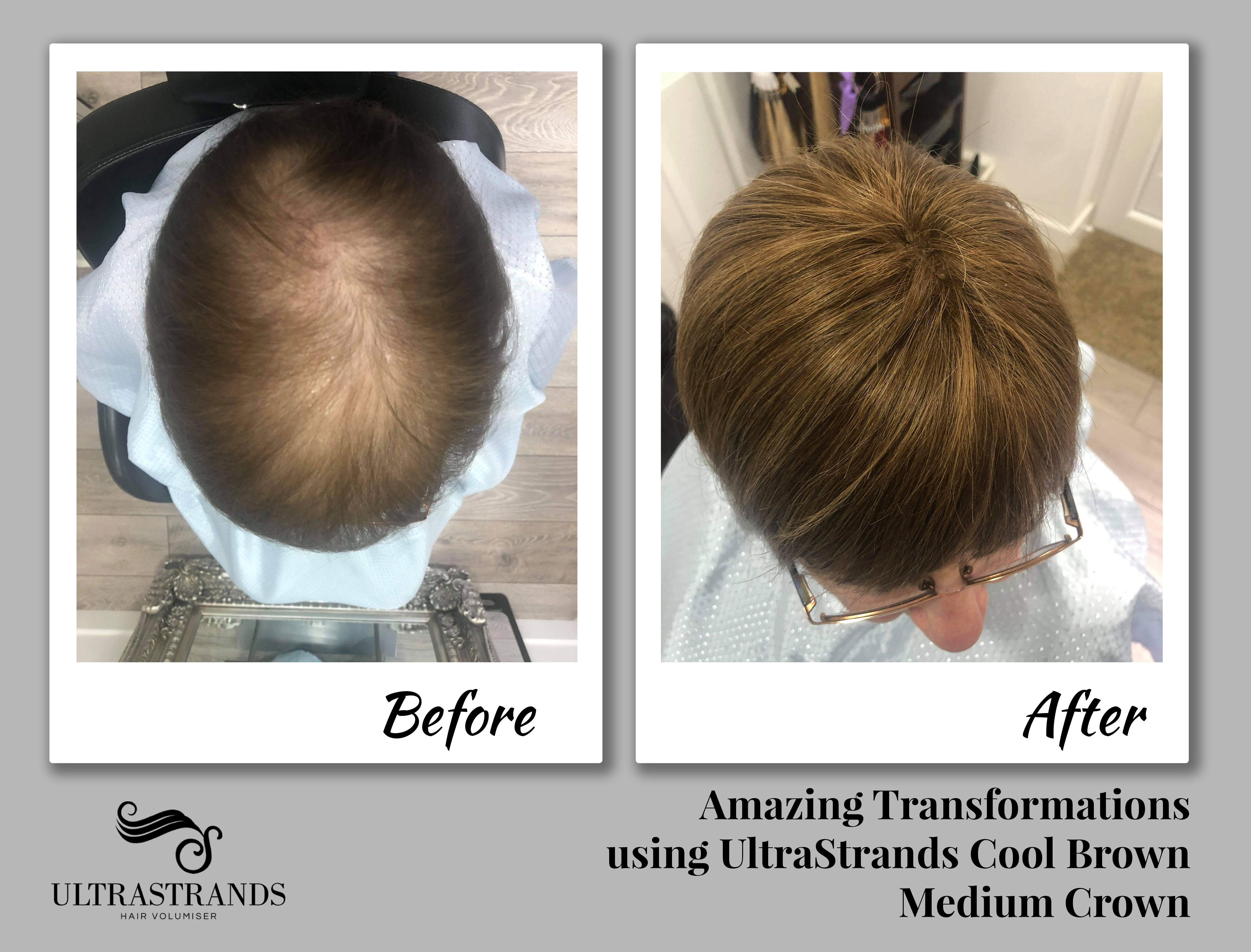 UltraStrands  hair Systems 