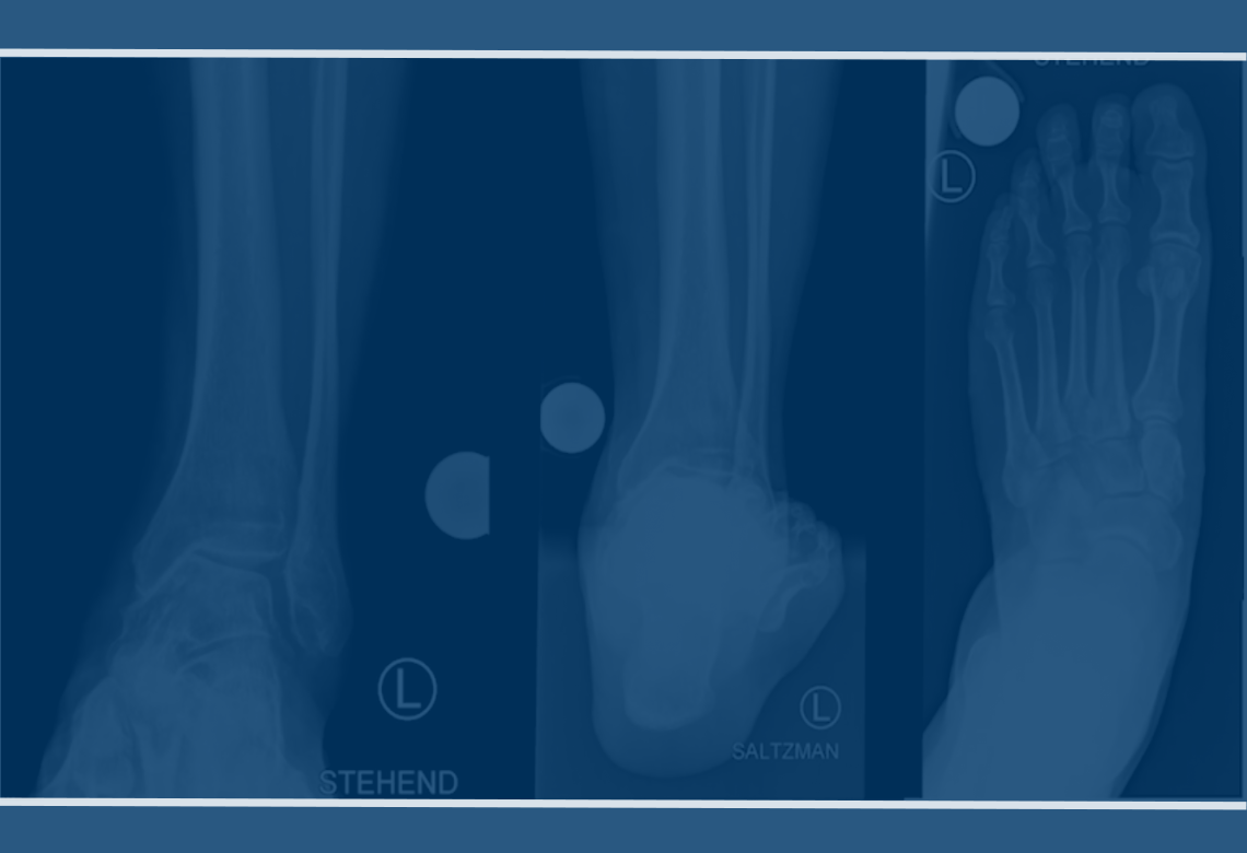 orthopaedic-foot-ankle