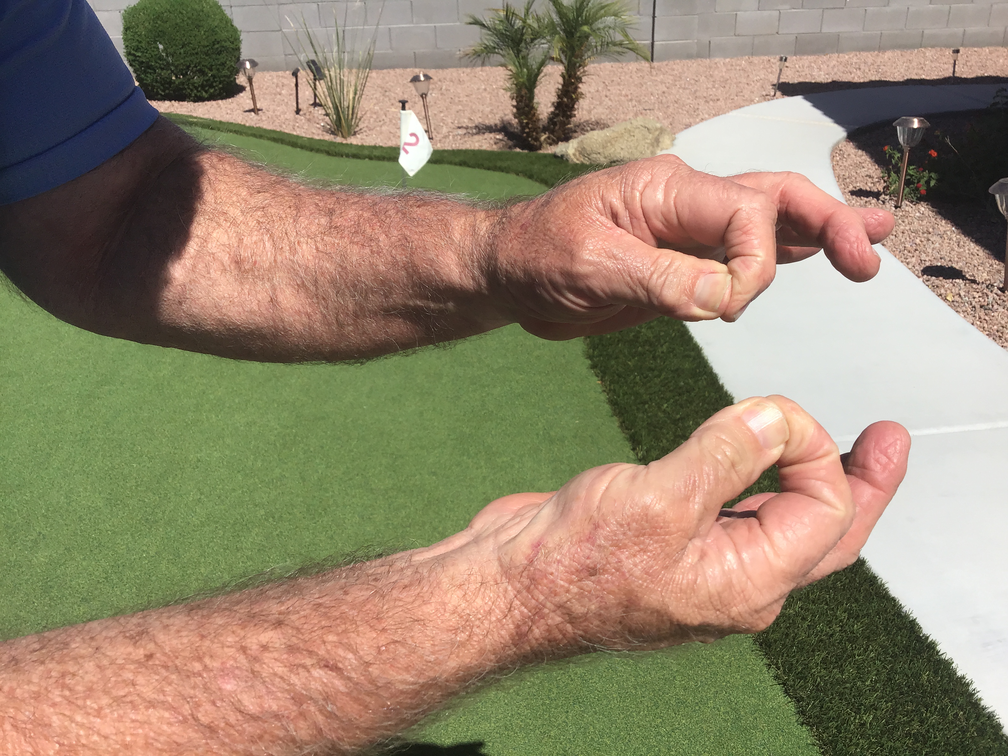 Eliminate the squeezing of thumb and fore finger