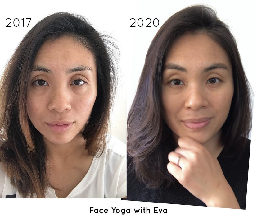 My 3 year Transformation after Face Yoga