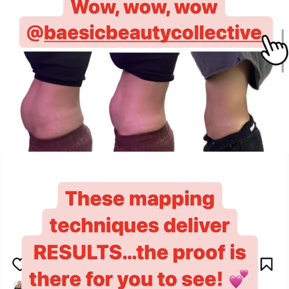 body transformation using Kelly's mapping technique