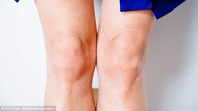 Saggy knee skin, loose skin, both knees, knee lift, aging skin