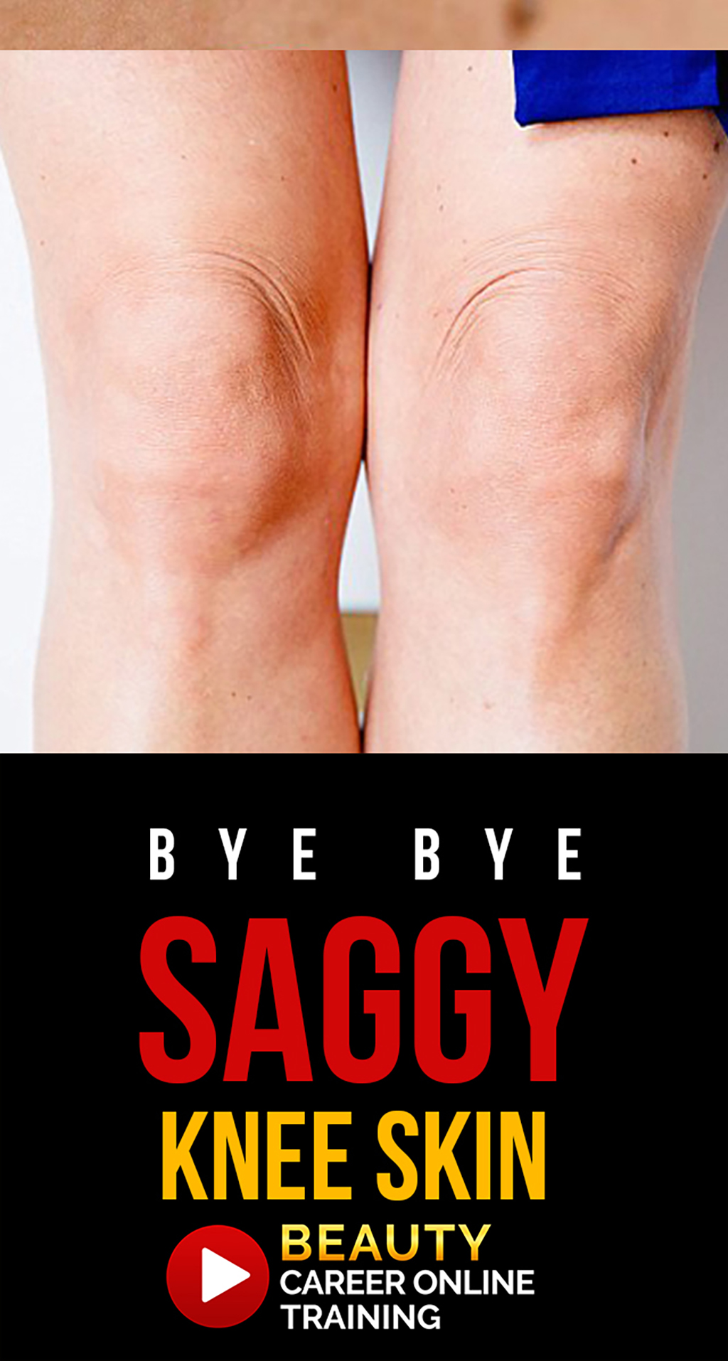 Knee skin, saggy knee skin, loose skin knees