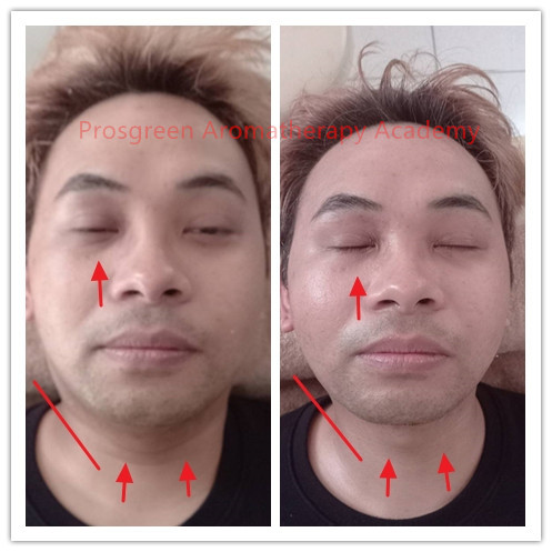 Before-After Meridian Massage