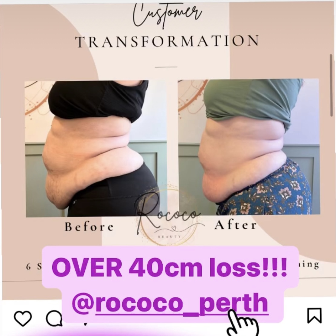 belly transformation using Gingerella Rox mapping technique