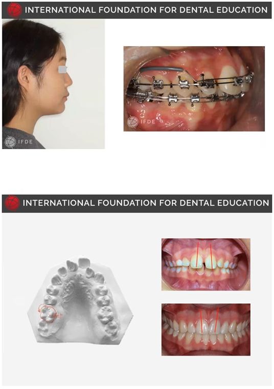 Orthodontic Diagnosis and Treatment Planning - Applied