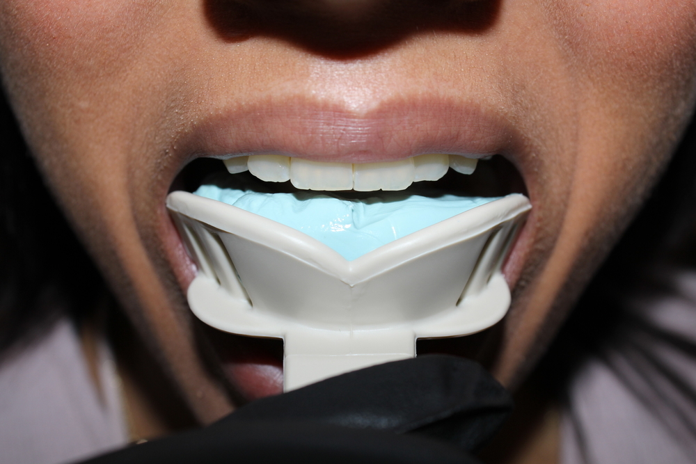 How to take a dental impression