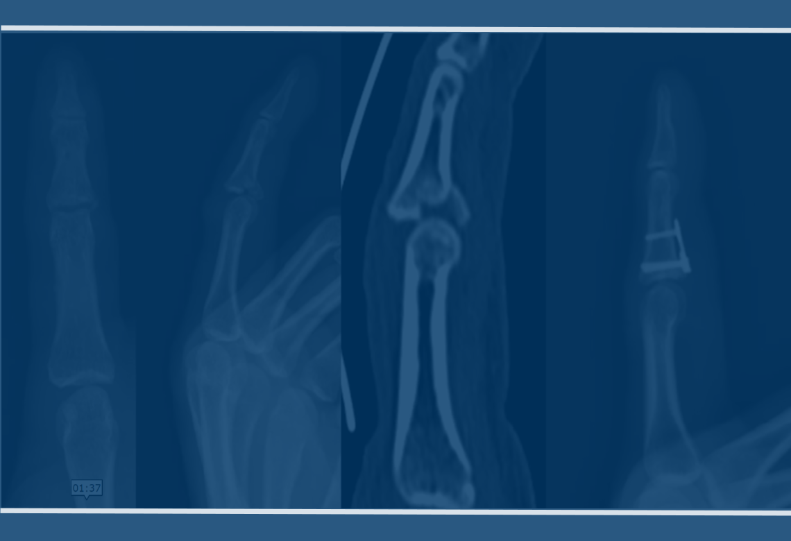 orthopaedic-foot-ankle