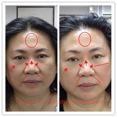 Facial Meridian Massage