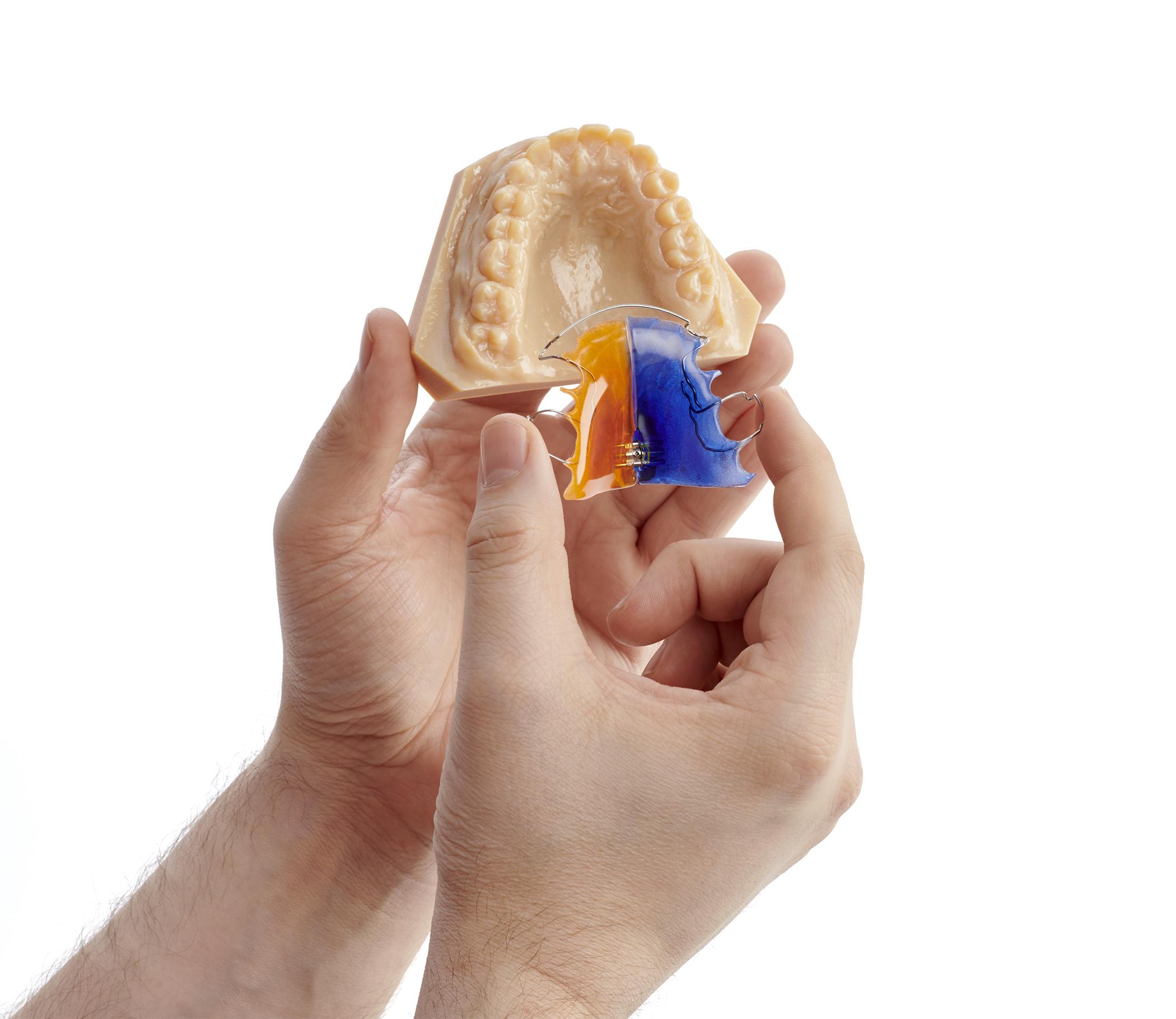 Mano sosteniendo modelo anatómico dental impreso en 3D