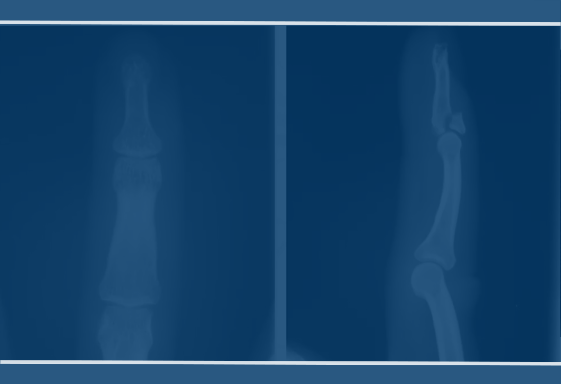 orthopaedic-foot-ankle
