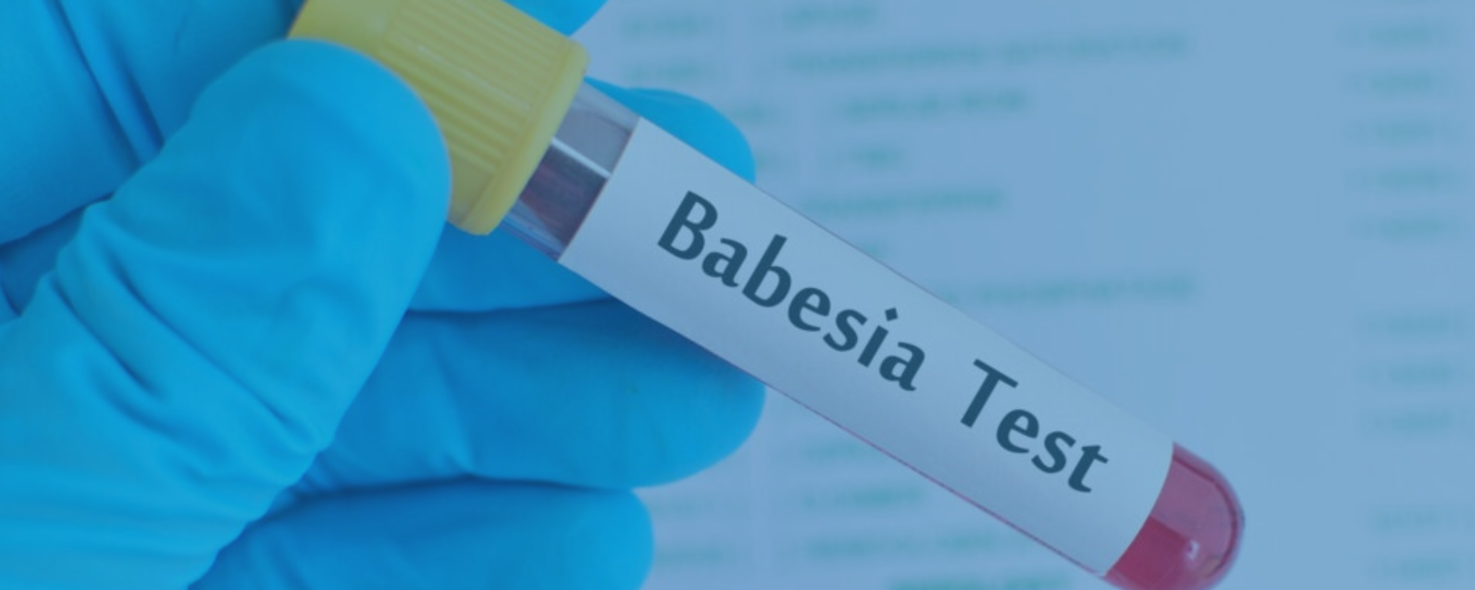 An Introduction to Human Babesiosis