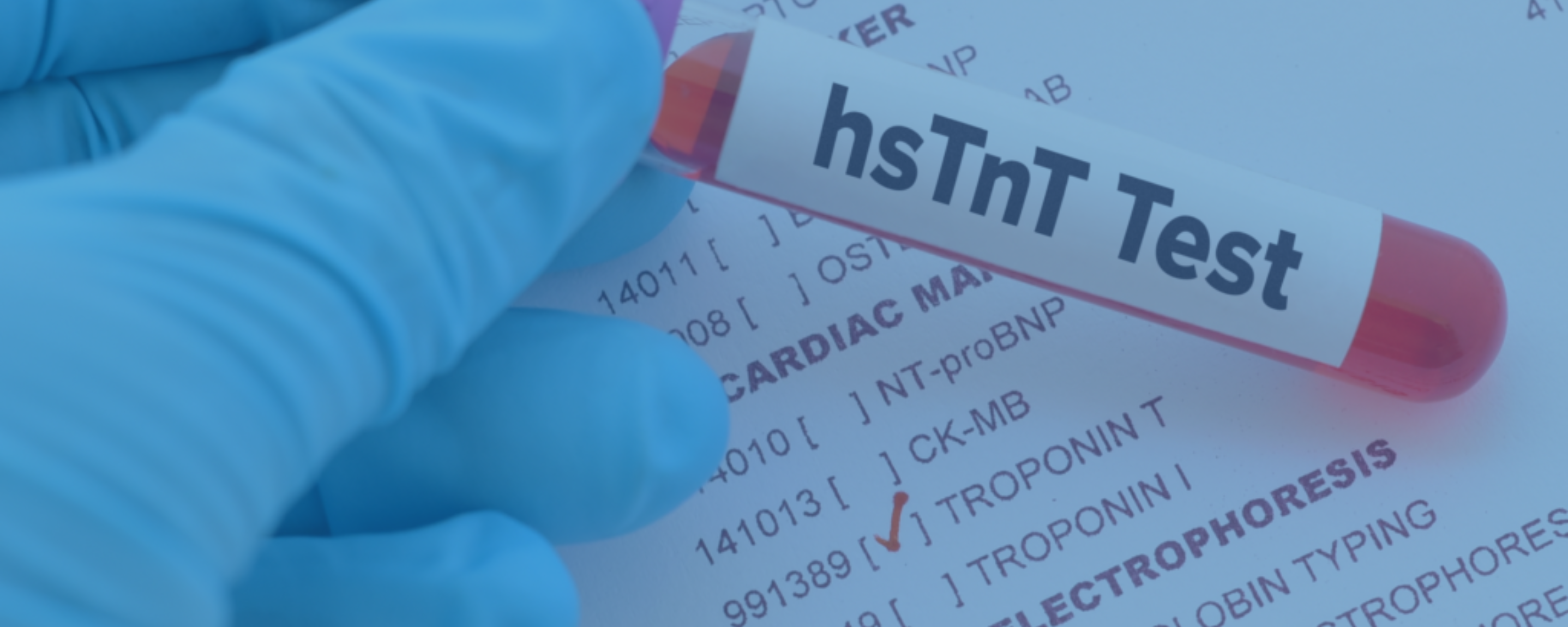 Measurement of high sensitivity troponin T in patients with early-stage Lyme disease: possible evidence for subclinical cardiac involvement