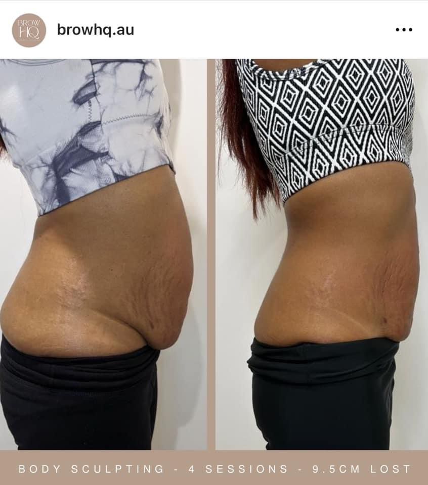 Body Sculpting by Gingerella Rox before & after photo