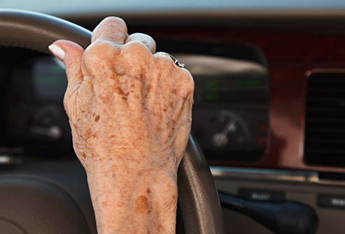 Erase Aging Hands Face Instantly! Remove age spots, sun spots, brown spots, acne spots
