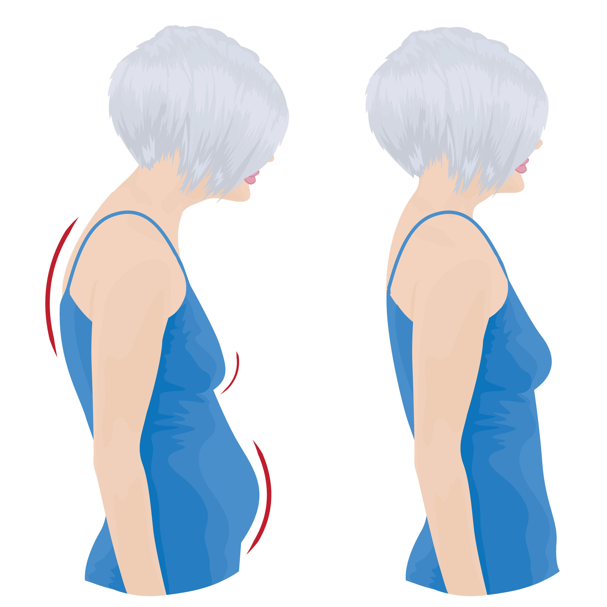 Improve Your Posture for Better Health