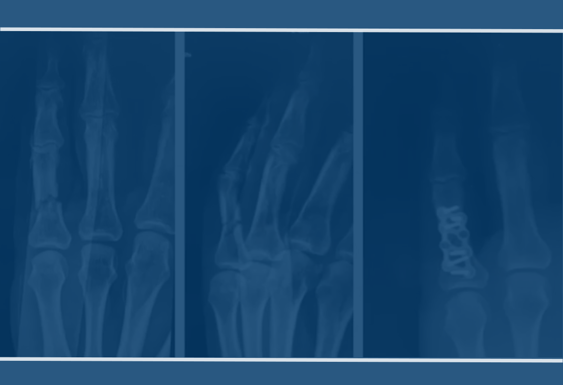 orthopaedic-foot-ankle