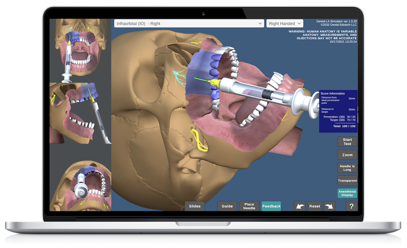 online Dental Local Anesthesia Simulator