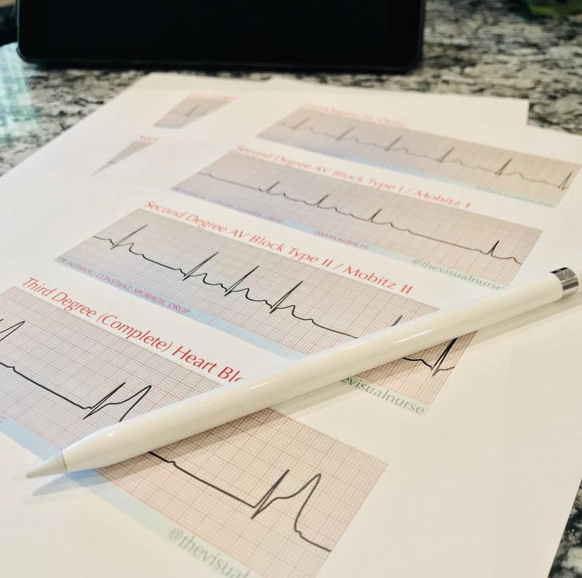 Basic Cardiac Rhythms Video Course The Visual Nurse