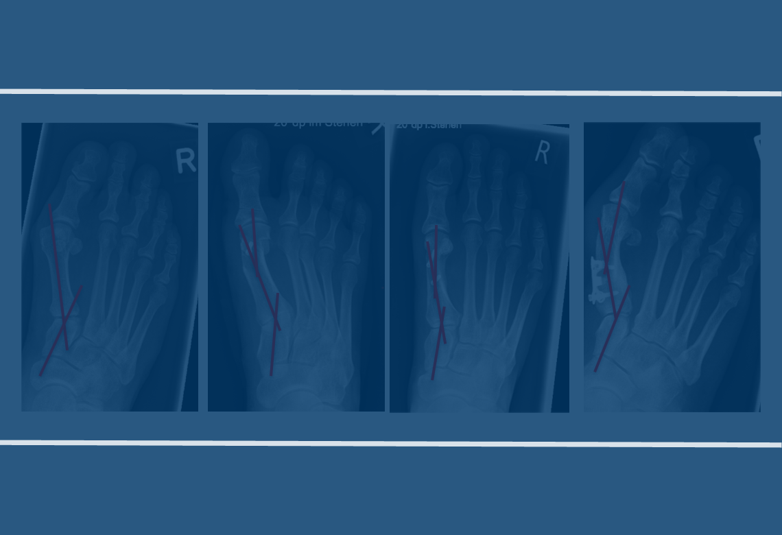 orthopaedic-foot-ankle