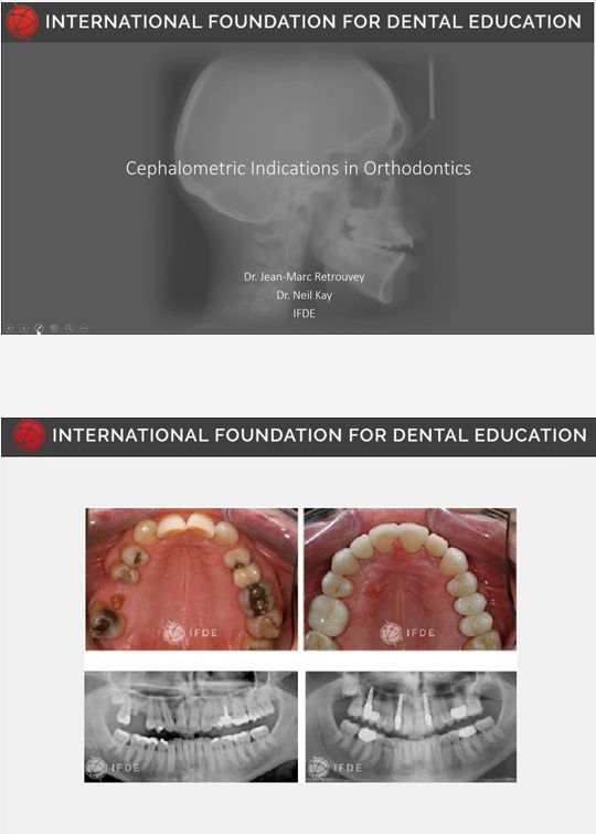 Orthodontic Diagnosis and Treatment Planning - Theoretical