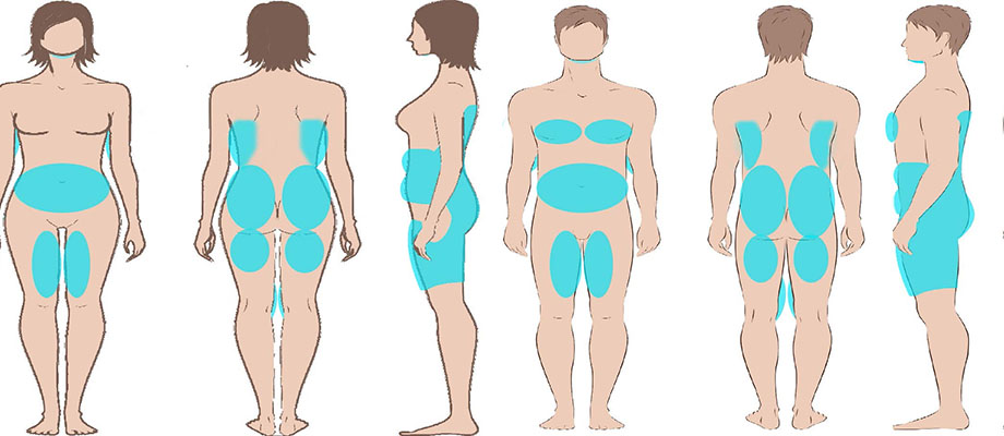 AQUALYX FAT DISSOLVING