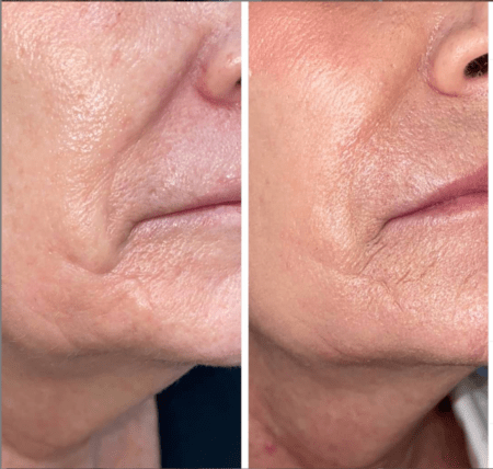 Natural organic skin wrinkles saggy for men and woman