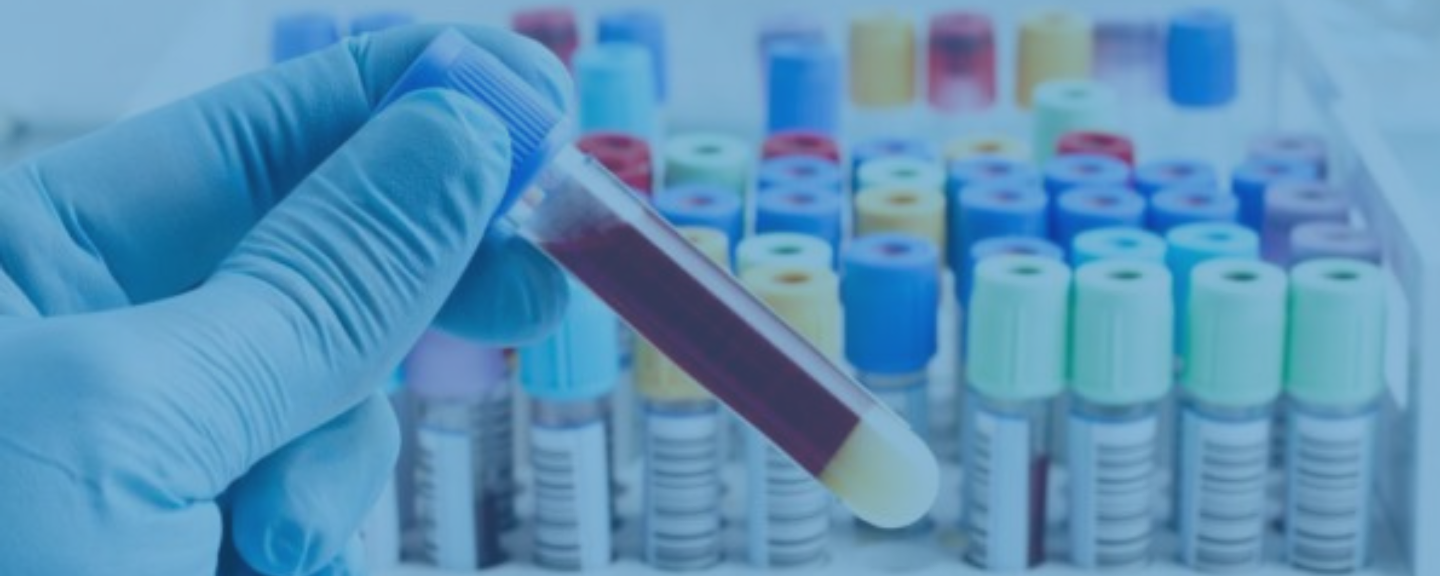 Serologic Testing in Lyme Disease