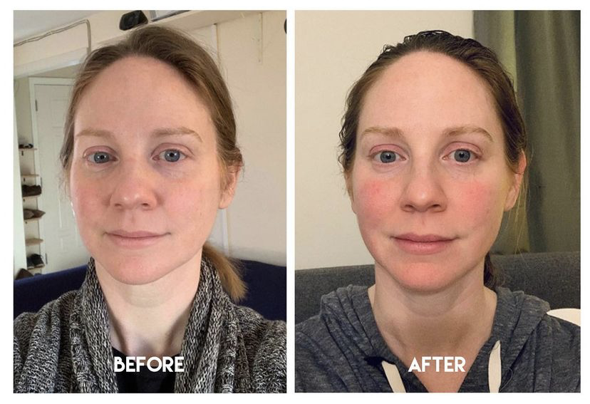 Katrina 21 day face yoga challenge results