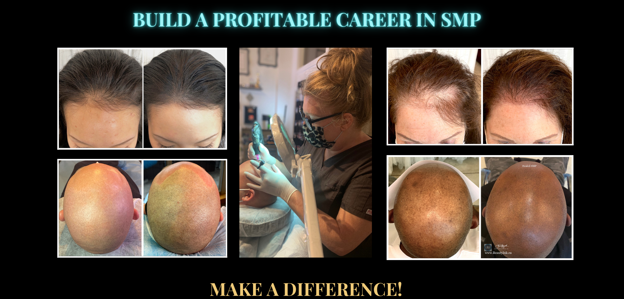 Build a profitable carrer in SMP scalp Micro-pigmnetation, Learn smp, Make a positive diffrence in peoples lives, learn hairloss solutions.