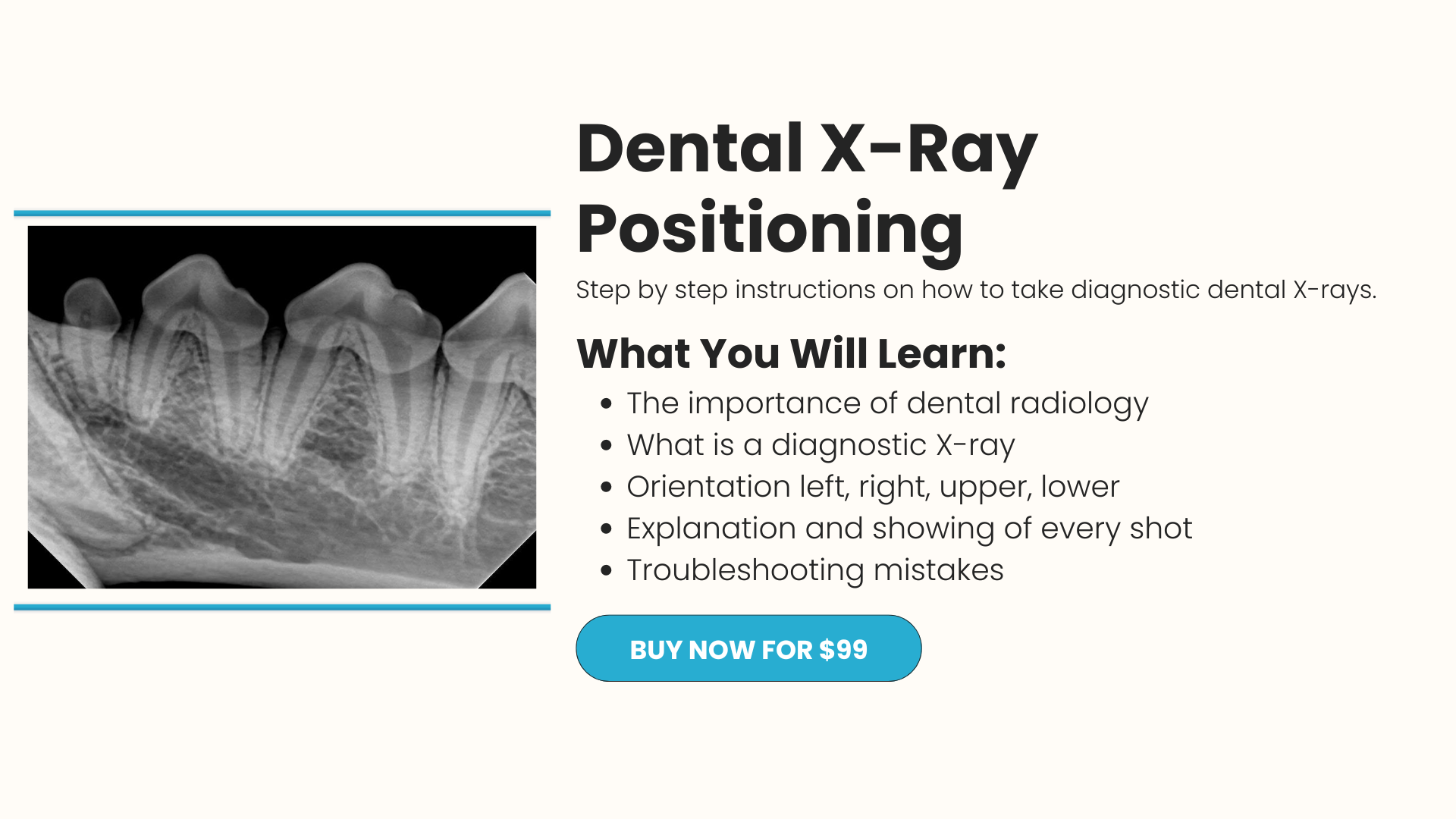 Dental X-Ray Positioning 101