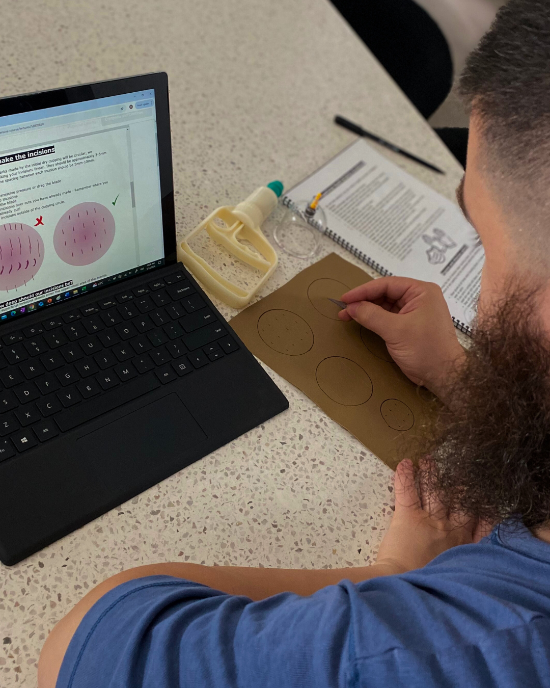 IPHM-certified Hijama therapy course with in-depth online modules and video demonstrations