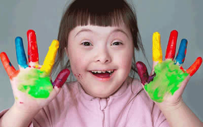 girl with Down syndrome