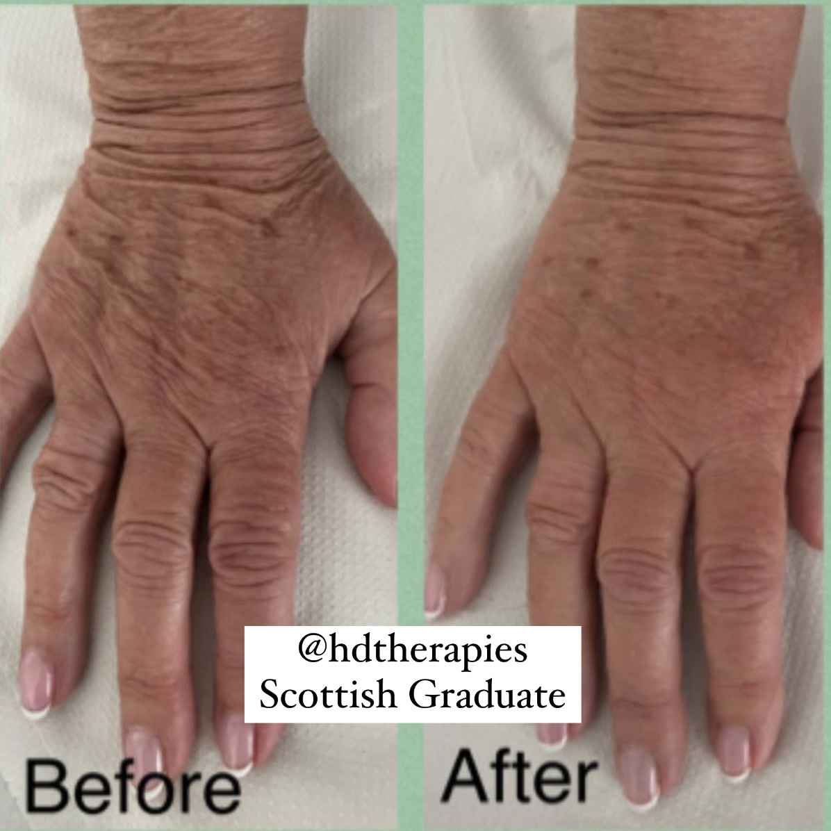 Body Sculpting by Gingerella Rox - hand transformation