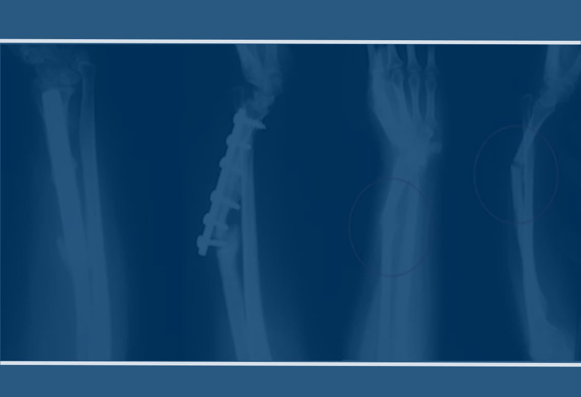 orthopaedic-foot-ankle