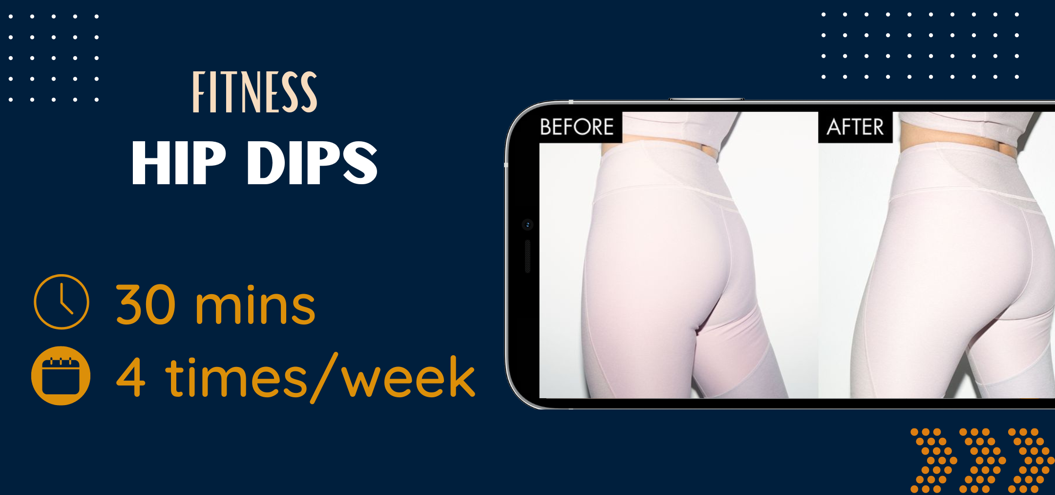 Before and After Hip Dips. Before and After Hip Dips