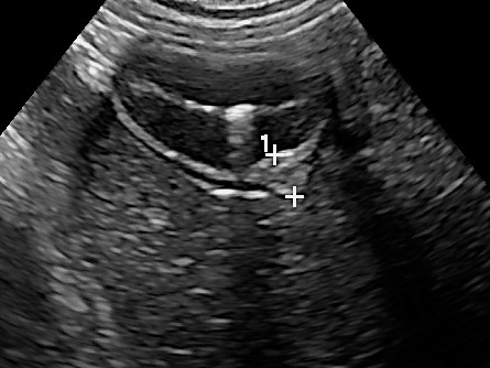 WAVE Soft Tissue Level 2 Ultrasound Intermediate to Advanced Duodenal papilla Veterinary