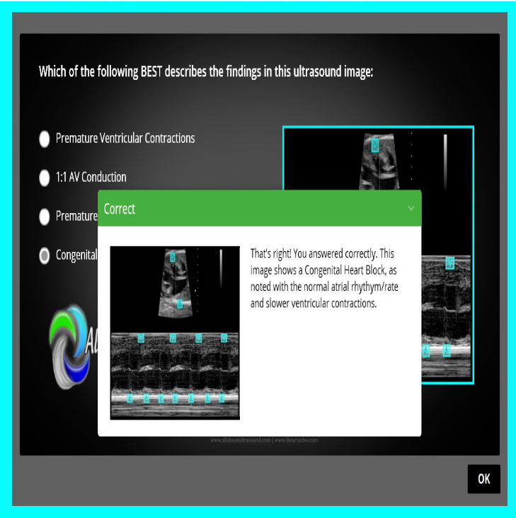 Fetal Echo Registry Review