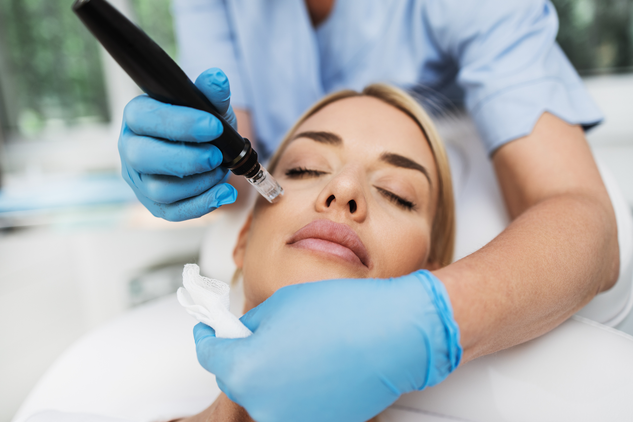 Microneedling 101