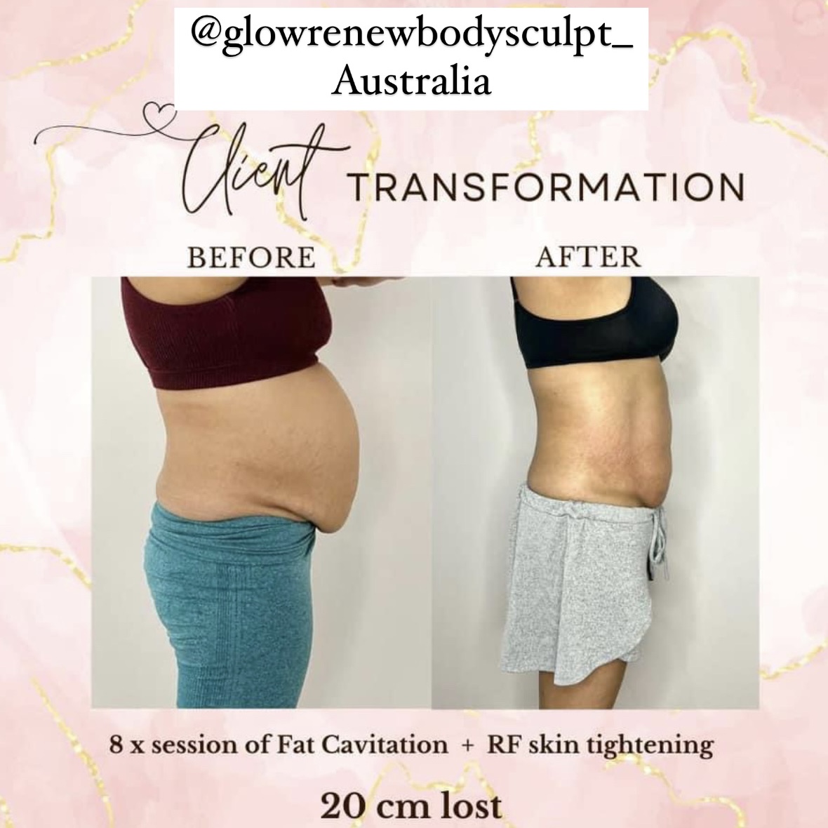 Body Sculpting by Gingerella Rox before & after pic