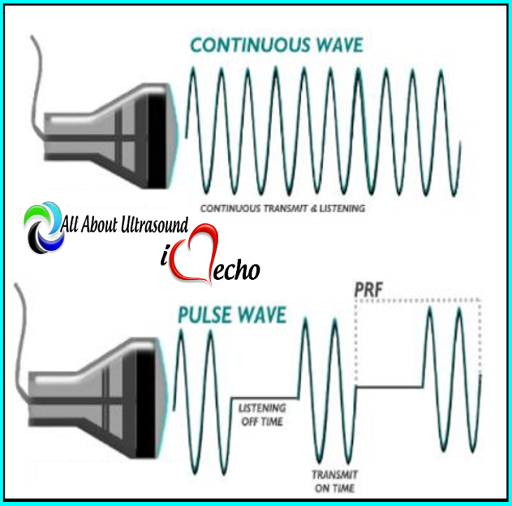 FREE SAMPLE - Ultrasound Physics SPI - Registry Review Quiz | All